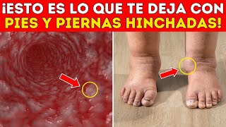 Tratamiento INFALIBLE para EXTERMINAR LA HINCHACIÓN en los PIES DE UNA VEZ POR TODAS [upl. by Eluj]