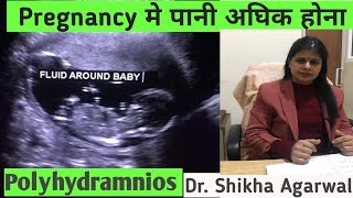 PolyhydramniosPregnancy प्रेग्नेंसी में बच्चों के चारो और अधिक पानी होनाdrshikhaagarwal [upl. by Cinnamon390]