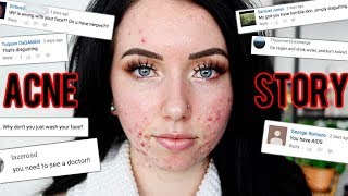 MY ACNE STORY amp Going on Accutane [upl. by Ahsikcin]