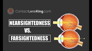 Nearsightedness Vs Farsightedness and the Difference Between the Two [upl. by Dranyam]