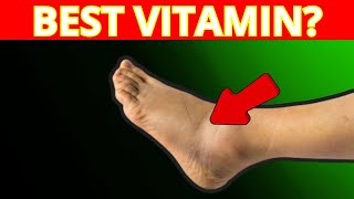 Top 5 Nutrients to Alleviate Swelling in Feet amp Legs [upl. by Naniac]