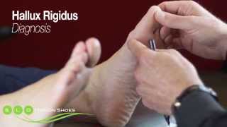 Hallux Rigidus Causes Diagnosis and Treatment [upl. by Endo41]