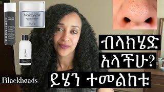 ብላክሄድ  ጥቁር ነጣጥብ ካላችሁ ይሄን ተመልከቱ Blackheads  How to remove and prevent [upl. by Lemmor607]