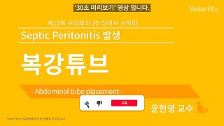 베터플릭스 복강 튜브 설치Abdominal tube placement수술 [upl. by Alrac]