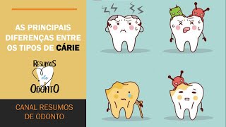 Principais diferenças entre os tipos de cáries  Resumos de Odonto [upl. by Ahsikahs651]