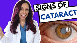 Signs of Cataracts  Eye Surgeon Explains [upl. by Endora]