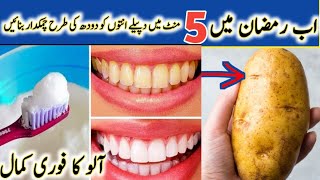 5 Natural Ways to Remove Tartar Buildup  teeth cleaning before and after [upl. by Morell]