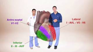 ECG for Beginners ECG Diagnosis of ST Elevation Myocardial Infarction STEMI [upl. by Giwdul771]