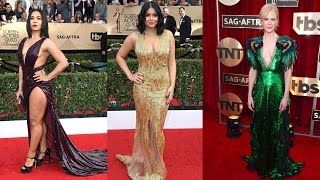 10 Worst Dressed Celebrities At SAG Awards 2017  Pastimers [upl. by Dott241]