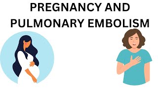 PULMONARY EMBOLISM IN PREGNANCY  ITS MANAGEMENT  MEDICINE HANDY POINTS [upl. by Stauder21]