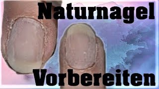 Nagelhaut entfernen  Tipps amp Tricks für Anfänger Gelnägel selber machen Teil 1 [upl. by Eelatan930]