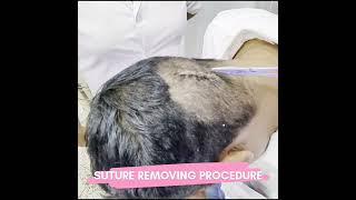 Suture Removing Procedure  Krishna Care Hospital [upl. by Llenwad]