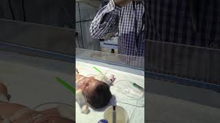 Putting ogtu in the stomach of a newborn baby😌👍 youtubeshorts nursing medical newbornbaby viral [upl. by Eceirtal]