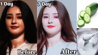 Japanese Secret Whitening Cream at Home 10 Shades to Lighten Skin Remove Dark Spots amp Pigmentation [upl. by Alieka136]