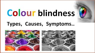 Colour blindness  Types Causes Symptoms Treatment [upl. by Maribelle]