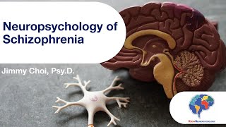 Neuropsychology of Schizophrenia [upl. by Catton441]