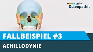 Achillessehnenentzündung  Achillodynie aus osteopathischer Sicht [upl. by Glialentn]