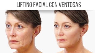 MASAJE FACIAL CON VENTOSAS PARA FLACIDEZ [upl. by Athene]