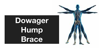 Dowager Hump Brace [upl. by Larsen]