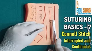 Intestinal anastomosis l Connell Stitch l OSCE skill stations part 7 l Surgical clinics [upl. by Ahseenak287]