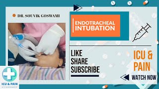 How to Perform Endotracheal Intubation A Clinical Demonstration [upl. by Ydde213]