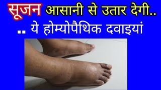 सूजन उतारने की बेहतरीन दवाएं best homeopathic medicine for oedema how to get rid of swelling easily [upl. by Narut591]