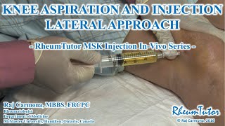 KNEE ASPIRATION  INJECTION LATERAL APPROACH  InVivo Series [upl. by Ynnaf]