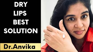 Dry skin care tips this winter by Dr Anvika [upl. by Leeann]