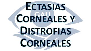 Clase 12 Ectasias Corneales Distrofias Corneales 22 Marzo 2022 [upl. by Aleyam176]