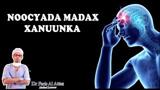 MADAXA MA KU XANUUNAA  Noocyada Madax Xanuunka iyo Sida loo Daaweyo  Dr faris [upl. by Ruder865]