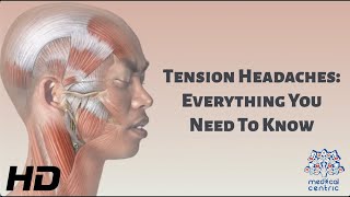 Tension Headaches Everything You Need To Know [upl. by Salahcin]