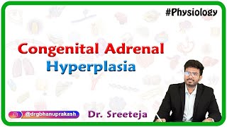 Congenital Adrenal Hyperplasia  USMLE Step 1 [upl. by Snilloc]