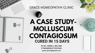 A Case StudyMolluscum contagiosum Cured in 15 days [upl. by Denis265]