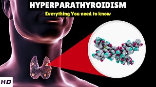 Hyperparathyroidism – Types Causes Signs and Symptoms Diagnosis amp Treatment [upl. by Gene]