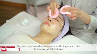 Ellisys Plus Fractional Needle RF system Made in KOREA  UNITY DERMA [upl. by Minta920]