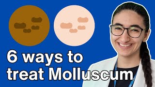 How to treat molluscum contagiosum with Pharmacist Virginia [upl. by Nalro]