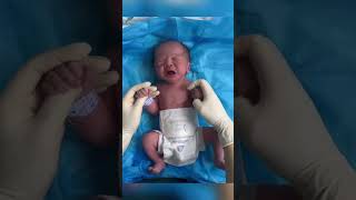 The nurse helped the newborn check his body The newborns small body is very cute [upl. by Prinz342]