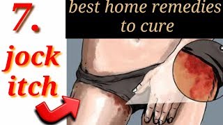 How to cure jock itch fast naturaly  7 best home treatment for jock itch by natural remediestips [upl. by Owiat]