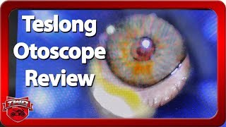 Teslong Digital Otoscope Review [upl. by Ashlen]