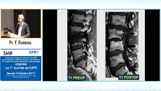 Finesses de lexamen clinique du rachis lombaire Pr F Rannou [upl. by Wakefield]