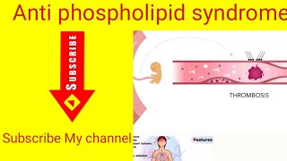 Skin diseaseAnti phospholipid syndrome [upl. by Josefina]