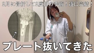 【手術】スノボで骨折amp手術をして半年経ったのでプレートを抜いてきました [upl. by Sile271]