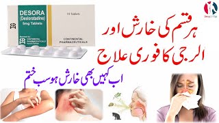 Desora 5mg tablet  Desora 5mg tablet uses in urdu  Desloratadine 5 mg tablets  Desora 5mg  hindi [upl. by Husein94]