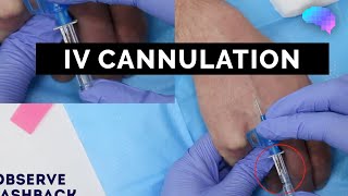 Intravenous IV cannulation  OSCE Guide  UKMLA  CPSA [upl. by Atis]