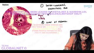 CNS  NON NEOPLASTIC LESIONS By Dr Illa jain khandelwal Pathology by Marrow Video Lecture [upl. by Ydiarf273]