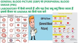 CBC SE GBP या PBS GENERAL BLOOD PICTURE or PERIPHERAL BLOOD SMEAR KI REPORT KAISE BANAYE [upl. by Lutero]