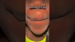 Des lèvres pulpeuses sans chirurgie cotedivoire america rire humour comedies challenge [upl. by Azeria]