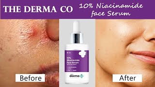 10 niacinamide serum derma co review10niacinamide faceserumskincare nightskincare100 effective [upl. by Shanie]