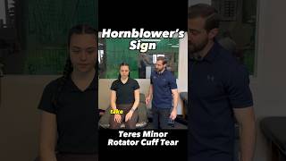 Hornblower’s Sign  Teres Minor Rotator Cuff Tear Diagnosis [upl. by Ardek]