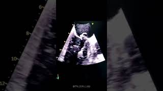 Whats this 🤨 echocardiography cardiology echocardiogram [upl. by Nnasor]